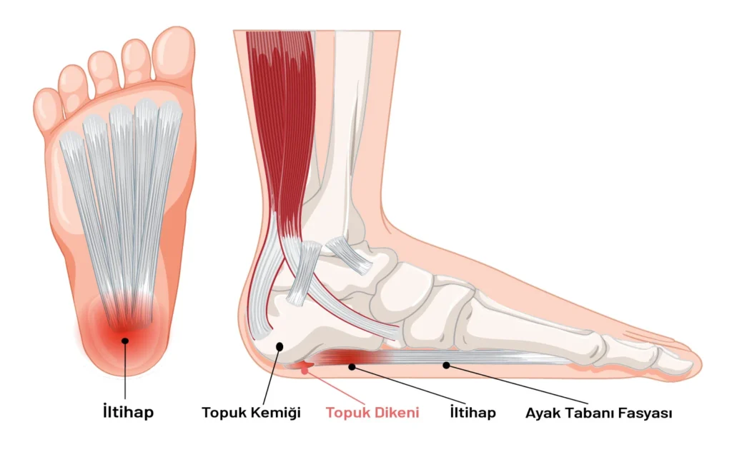 topuk-dikeni